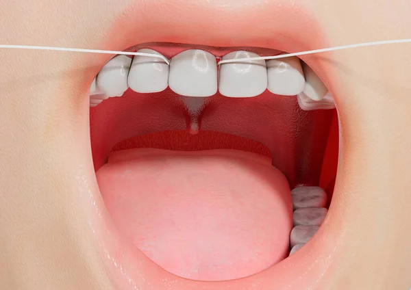 Zubní Nit Přecházející Mezi Zuby Hygieně Lidských Úst Ilustrace — Stock fotografie