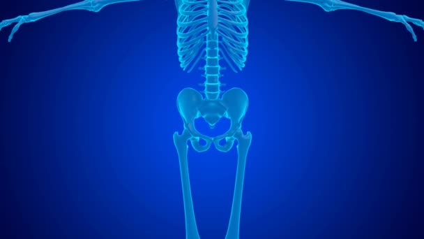 Blue Hologram Pain Femur Joint Caused Cartilage Wear Animation — Stock Video
