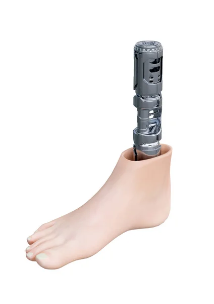 Tecnologia Avançada Prótese Ortopédica Perna Humana Isolada Fundo Branco Ilustração — Fotografia de Stock