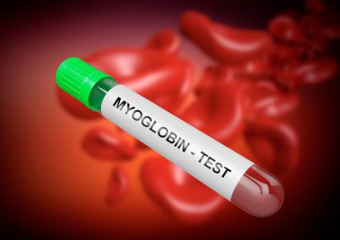 Miyoglobin testi kas ve kardiyak yaralanmaların oluşumunu belirlemek için yapılır. 3B Görüntü