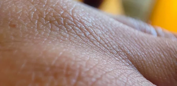 人間の皮膚の背景の詳細 医学と皮膚科の概念 人間の皮膚の背景の詳細 — ストック写真