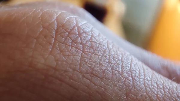 배경의 피부과의 인간의 — 스톡 사진