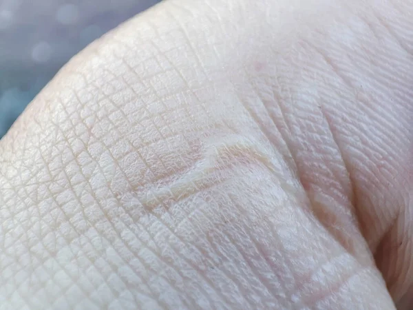 Padrão Pele Macro Close Superfície Humana Saudável Detalhe Pele Mão — Fotografia de Stock