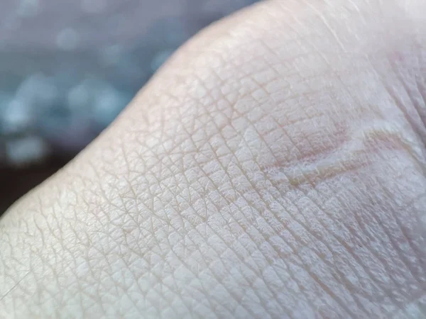 Zbliżenie Makro Skóry Wzór Zdrowa Ludzka Powierzchnia Detal Skóry Dłoni — Zdjęcie stockowe