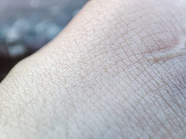Padrão Pele Macro Close Superfície Humana Saudável Detalhe Pele Mão — Fotografia de Stock