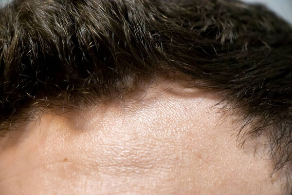 Крупный план лба и линии волос человека, показывающий здоровые волосы и текстуру кожи. Идеально подходит для красоты здоровья или ухода темы.