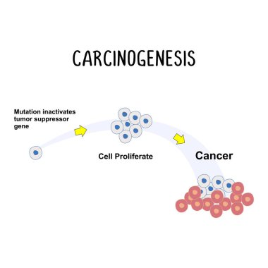 Kanserogenez: Genetik mutasyonlar ve hücre davranışlarındaki değişiklikleri içeren kanser gelişimi süreci.