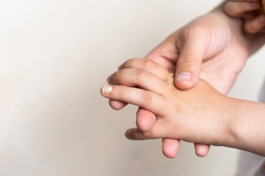 Tırnağı kırık bir çocuk eli. Acı veren çivi yaralı makro görüntüyü kaybetti