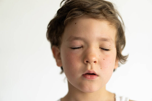 The boy was swollen from allergies. Allergy from pollen or food. Allergy concept