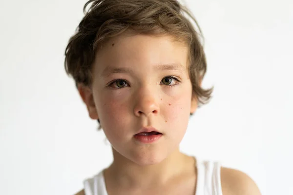 Fiú Megduzzadt Allergiától Allergia Pollentől Vagy Ételtől Allergia Fogalma — Stock Fotó