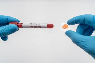 Doktor elinde COVID 19 Coronavirus aşısı tutuyor, örnek tüpte kan örneği, aşı ve şırınga enfeksiyonu COVID-19 'dan korunma, aşılama ve tedavi için kullanılıyor.