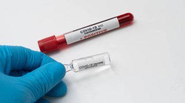 Doktor elinde COVID 19 Coronavirus aşısı tutuyor, örnek tüpte kan örneği, aşı ve şırınga enfeksiyonu COVID-19 'dan korunma, aşılama ve tedavi için kullanılıyor.
