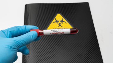 Doktor elinde COVID 19 Coronavirus aşısı, numune tüpünde enfekte kan örneği, aşı ve şırınga var COVID-19 'dan korunma, aşılama ve tedavi için kullanılıyor..