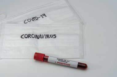 COVID 19 Coronavirus, örnek tüpte enfekte kan örneği var.