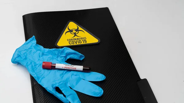 Covid Koronawirus Zakażona Próbka Krwi Probówce Szczepionka Strzykawka Wstrzykiwań Stosowany — Zdjęcie stockowe