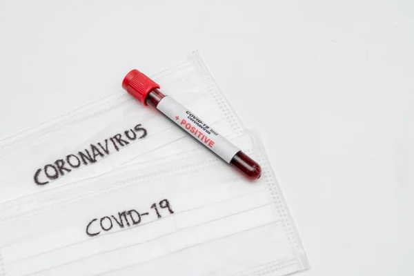 stock image COVID 19 Coronavirus, infected blood sample in the sample tube