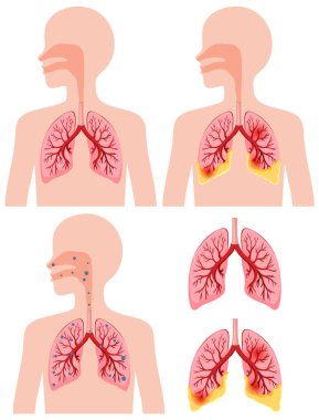 Human lungs icons collection illustration