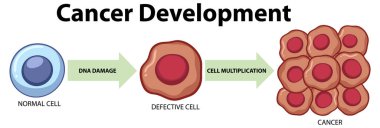 Tumor cell and cancer development illustration