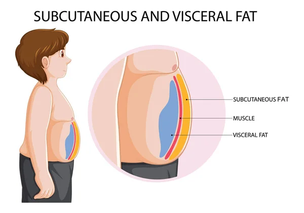 Subcutaneous Visceral Fat Diagram Illustration — Wektor stockowy