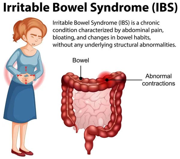 Sindrome Dell Intestino Irritabile Ibs Illustrazione Infografica — Vettoriale Stock