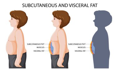 Subcutaneous and visceral fat diagram illustration