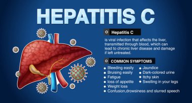 Hepatit C Infographic illüstrasyonunun belirtileri