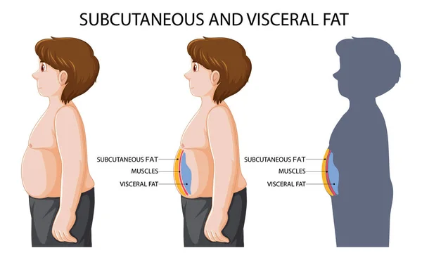 皮下和内脏脂肪图说明 — 图库矢量图片