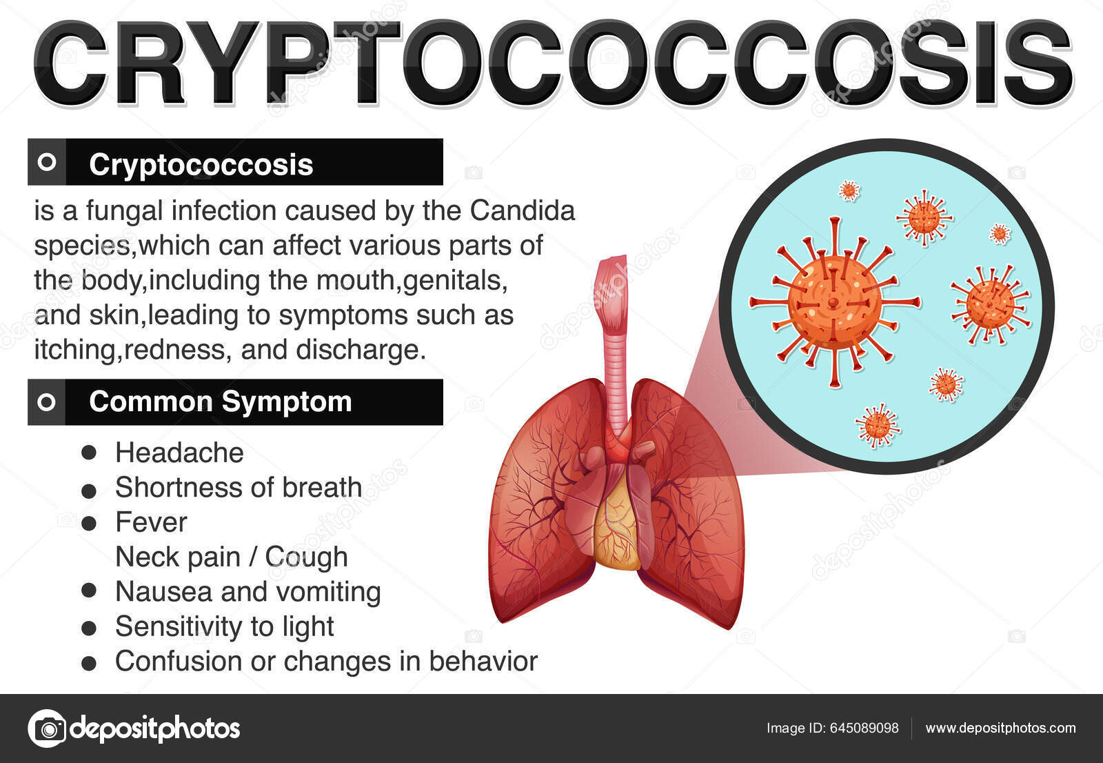 Informative Poster Cryptococcosis Illustration Stock Vector by  ©blueringmedia 645089098