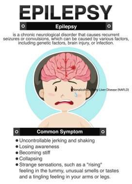 Epilepsi illüstrasyonunun bilgilendirici posteri