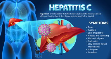Hepatit C illüstrasyonunun bilgilendirici belirtileri