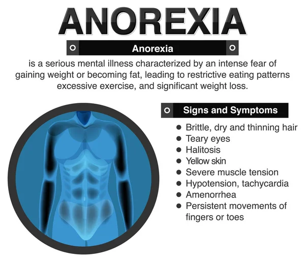 Anorexia Anorexia Sus Efectos Cuerpo Ilustración — Vector de stock