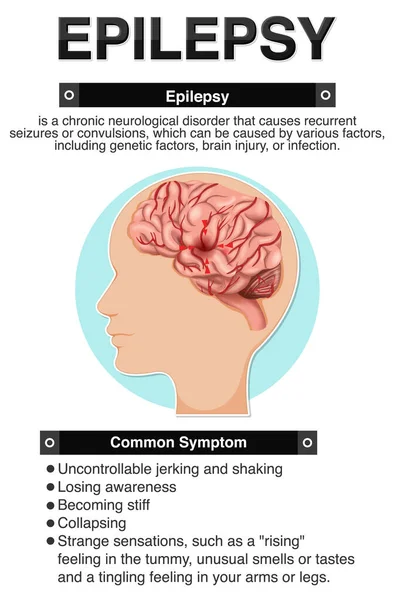 Poster Informatif Untuk Ilustrasi Epilepsi - Stok Vektor