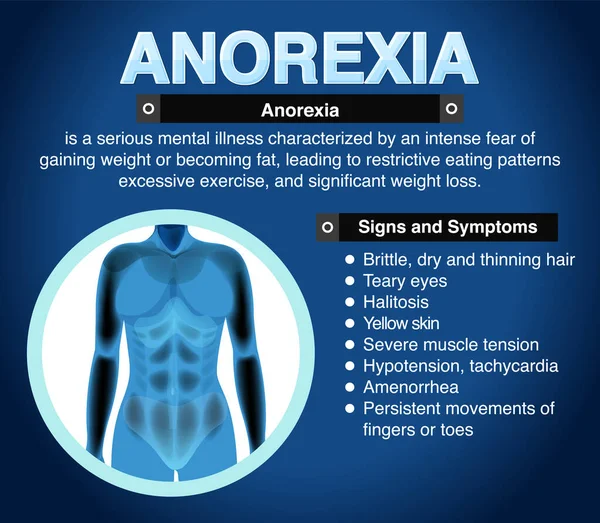 Cartel Informativo Anorexia Trastorno Alimentario Ilustración — Vector de stock