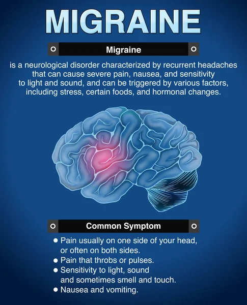 Affiche Informative Illustration Migraine — Image vectorielle