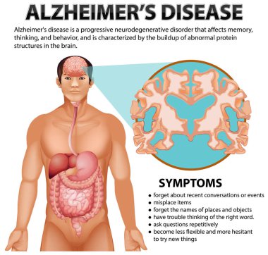 Alzheimer Hastalığı illüstrasyonunun bilgilendirici posteri