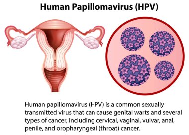 Açıklama ile insan Papillomavirus