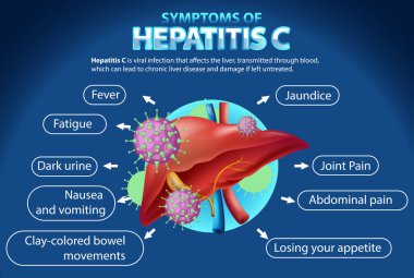 Hepatit C illüstrasyonunun bilgilendirici belirtileri