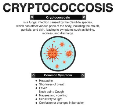 Cryptococcosis illüstrasyonunun bilgilendirici posteri