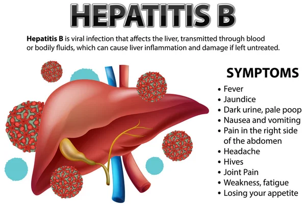Symptoms Hepatistis Illustration — Stock Vector