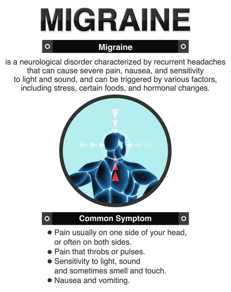 Informační Plakát Ilustrací Migrény — Stockový vektor