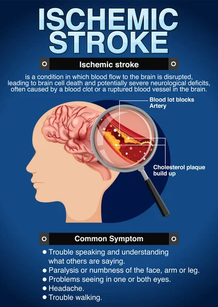 뇌졸중 인상적 포스터 — 스톡 벡터