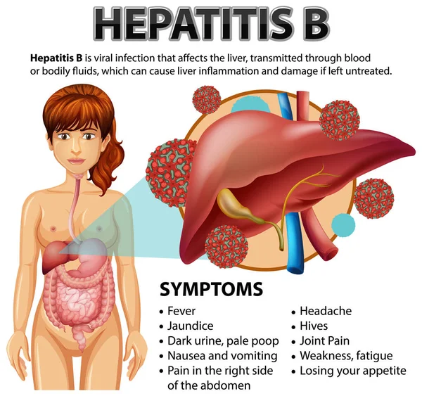 Symptoms Hepatitis Illustration — Stock Vector