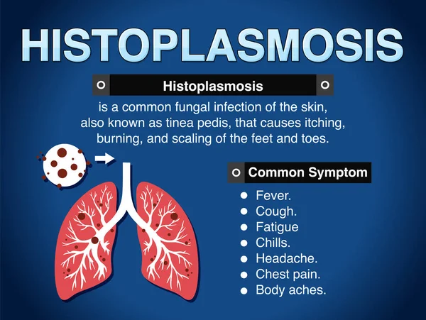Histoplasmosis Illüstrasyonunun Bilgilendirici Posteri — Stok Vektör