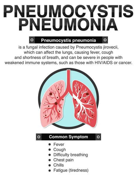 Информационный Плакат Иллюстрации Пневмоцистных Пневмоний — стоковый вектор