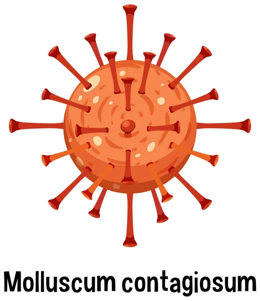 Molluscum Contagiosum Текстовой Иллюстрацией — стоковый вектор