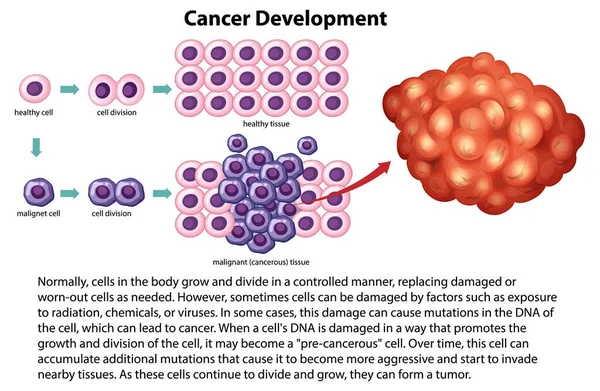 Vettore Sviluppo Del Cancro Con Illustrazione Delle Informazioni — Vettoriale Stock