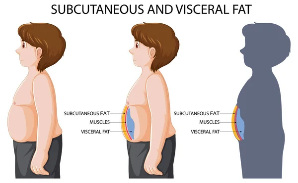 Subcutaneous Visceral Fat Diagram Illustration — Vector de stock