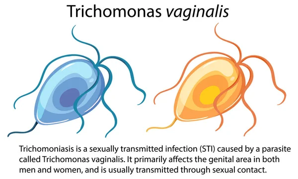 Trichomonas Vaginalis Com Ilustração Explicativa — Vetor de Stock