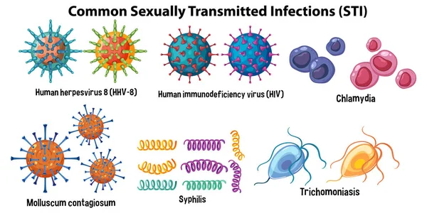 Infecciones Transmisión Sexual Its Comunes Ilustración — Vector de stock