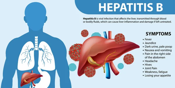 Symtom Hepatit Infografisk Illustration — Stock vektor